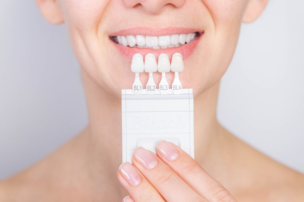 veneer color comparison