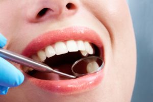 close up of mouth at dentist