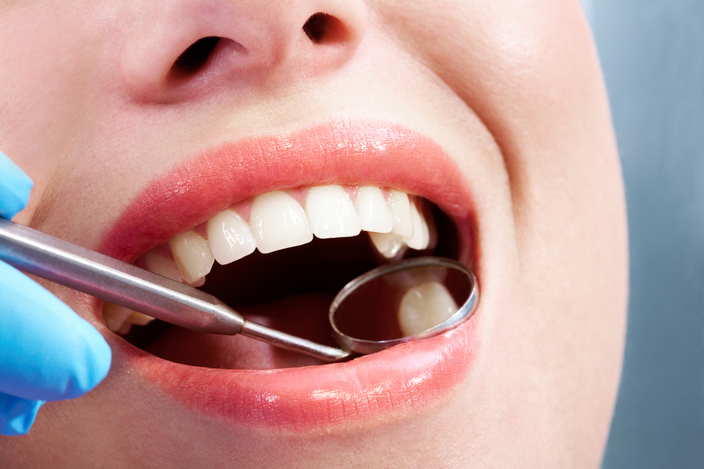 Close-up of a patient’s mouth during a dental examination, featuring a dental mirror and explorer, emphasizing oral health and preventive care at Robles Family Dental in Berwyn, IL.
