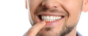 man with gum inflammation