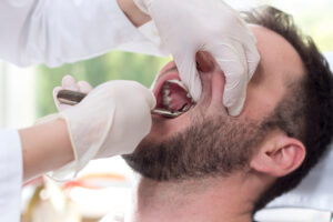 Dental professional examining a patient's mouth with dental tools, emphasizing emergency care for cracked or broken teeth.