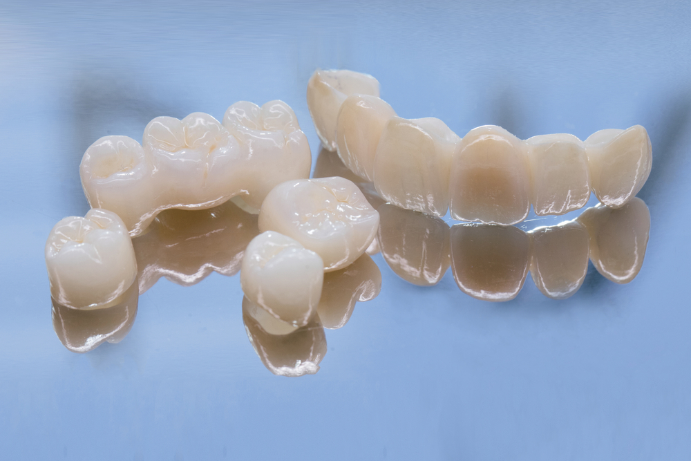 Dental crowns in various shapes and sizes, reflecting light, representing options for restoring damaged teeth at Robles Family Dental.
