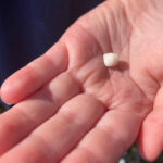 Hand holding a knocked-out tooth, emphasizing urgent dental care needs and immediate action for tooth preservation.