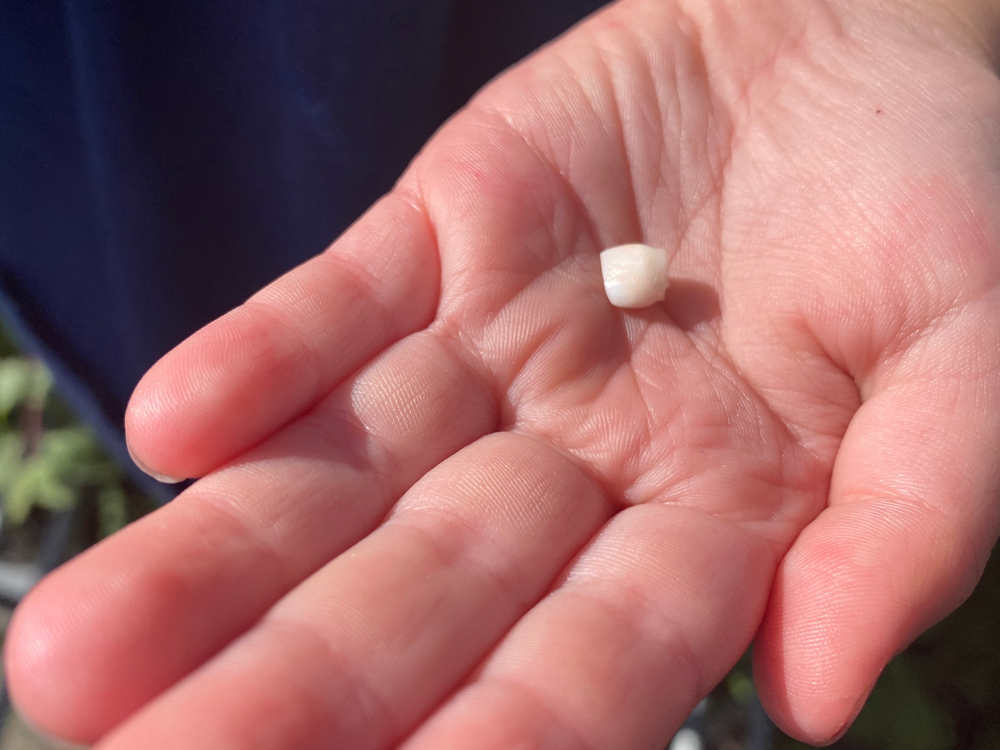A person holding an avulsed tooth in their palm, illustrating the importance of immediate care after a knocked-out tooth.
