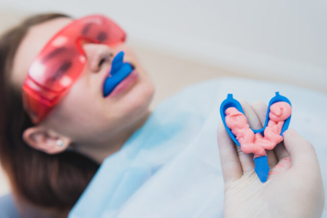 fluoride treatment for adults