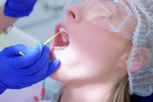 gentle fluoride application to adult teeth