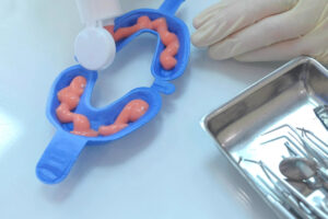 fluoride in tray